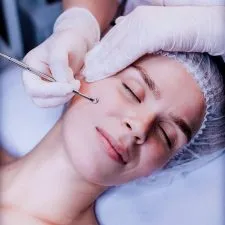 1CURO E PROCEDIMENTO DE LIMPEZA DE PELE