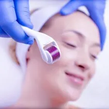 2CURSO E PROCEDIMENTO MICROAGULHAMENTO FACIAL