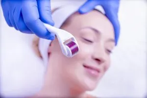 2CURSO E PROCEDIMENTO MICROAGULHAMENTO FACIAL