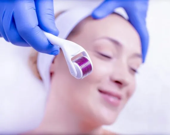 2CURSO E PROCEDIMENTO MICROAGULHAMENTO FACIAL