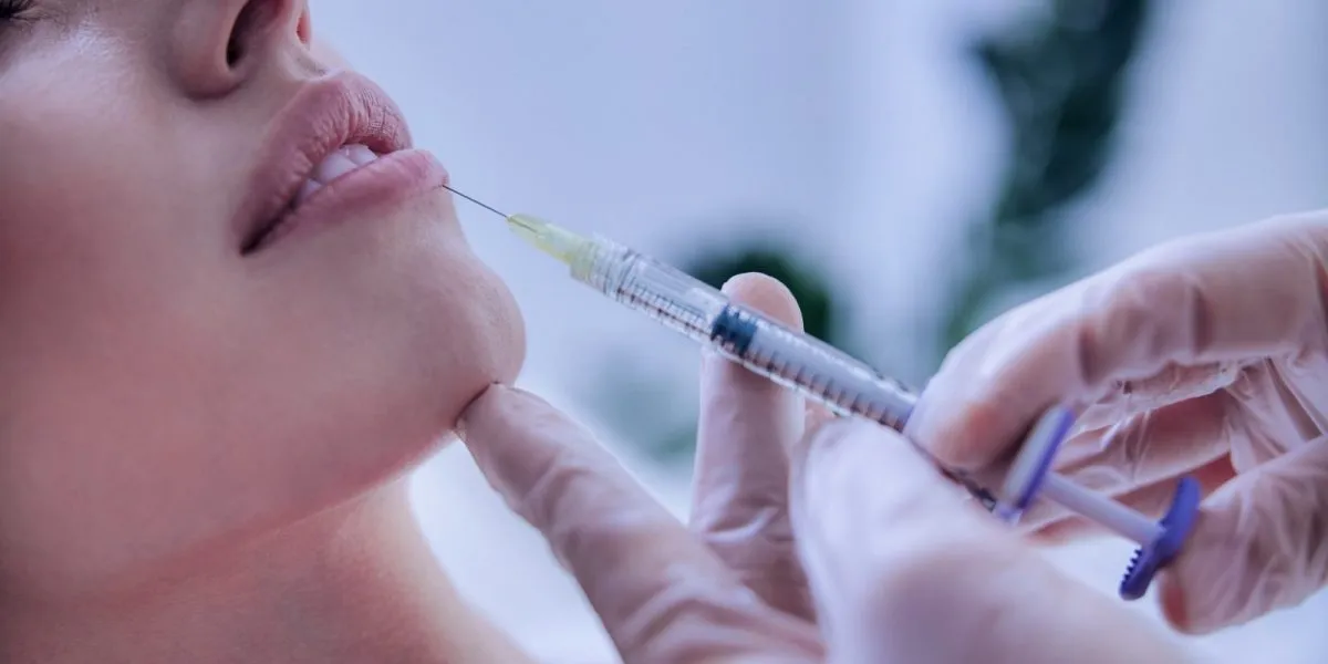 PREENCHIMENTO LABIAL
