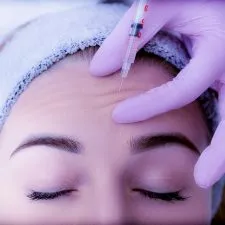PROCEDIMENTO TOXINA BOTULINICA